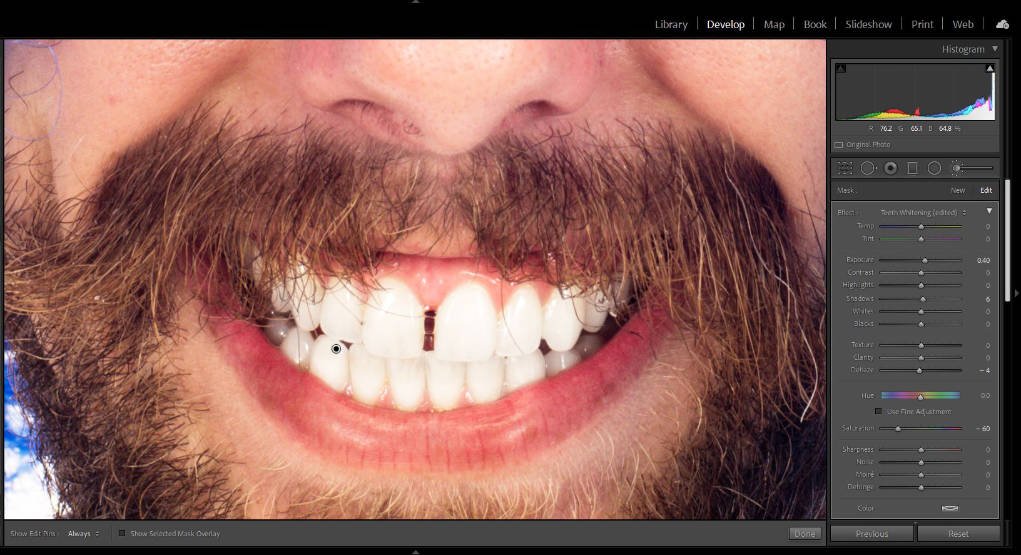 screen capture of resulting effect of teeth whitening in Lightroom.