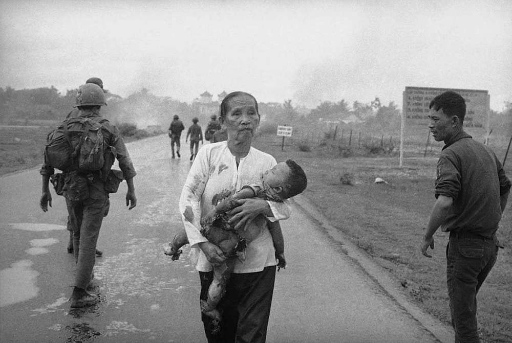 A woman walks away with a napalm burned child in Vietnam - Black and white documentary image by Nick Ut.